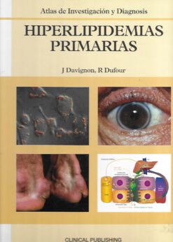 39486 247x346 - HIPERLIPIDEMIAS PRIMARIAS ATLAS DE INVESTIGACION Y DIAGNOSIS