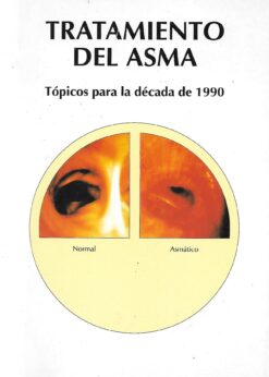 43140 247x346 - TRATAMIENTO DEL ASMA TOPICOS PARA LA DECADA DE 1990