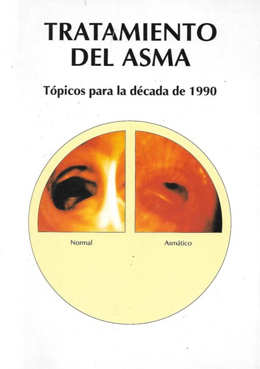 43140 510x723 - TRATAMIENTO DEL ASMA TOPICOS PARA LA DECADA DE 1990