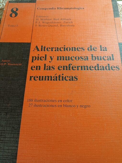 13084 510x680 - ALTERACIONES DE LA PIEL Y MUCOSA BUCAL EN LAS ENFERMEDADES REUMATICAS